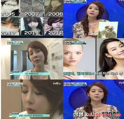 韩国一女子上节目自曝7年整形近120次 